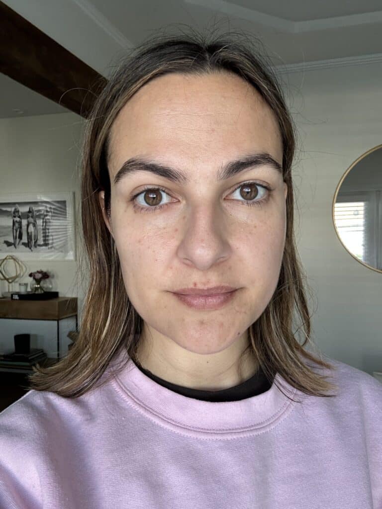 after ice rolling