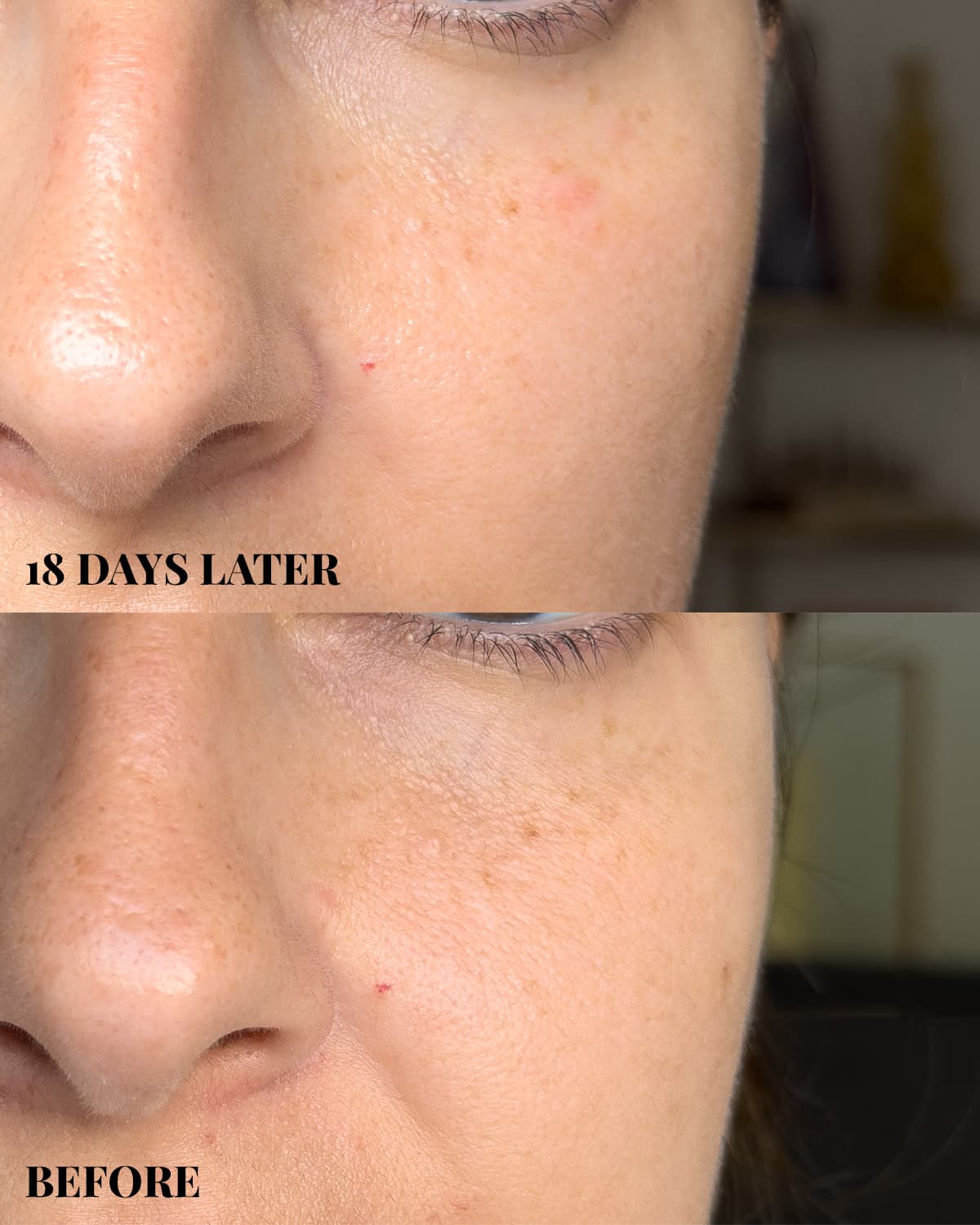ZIIP Halo before and results ZIIP Halo before and results