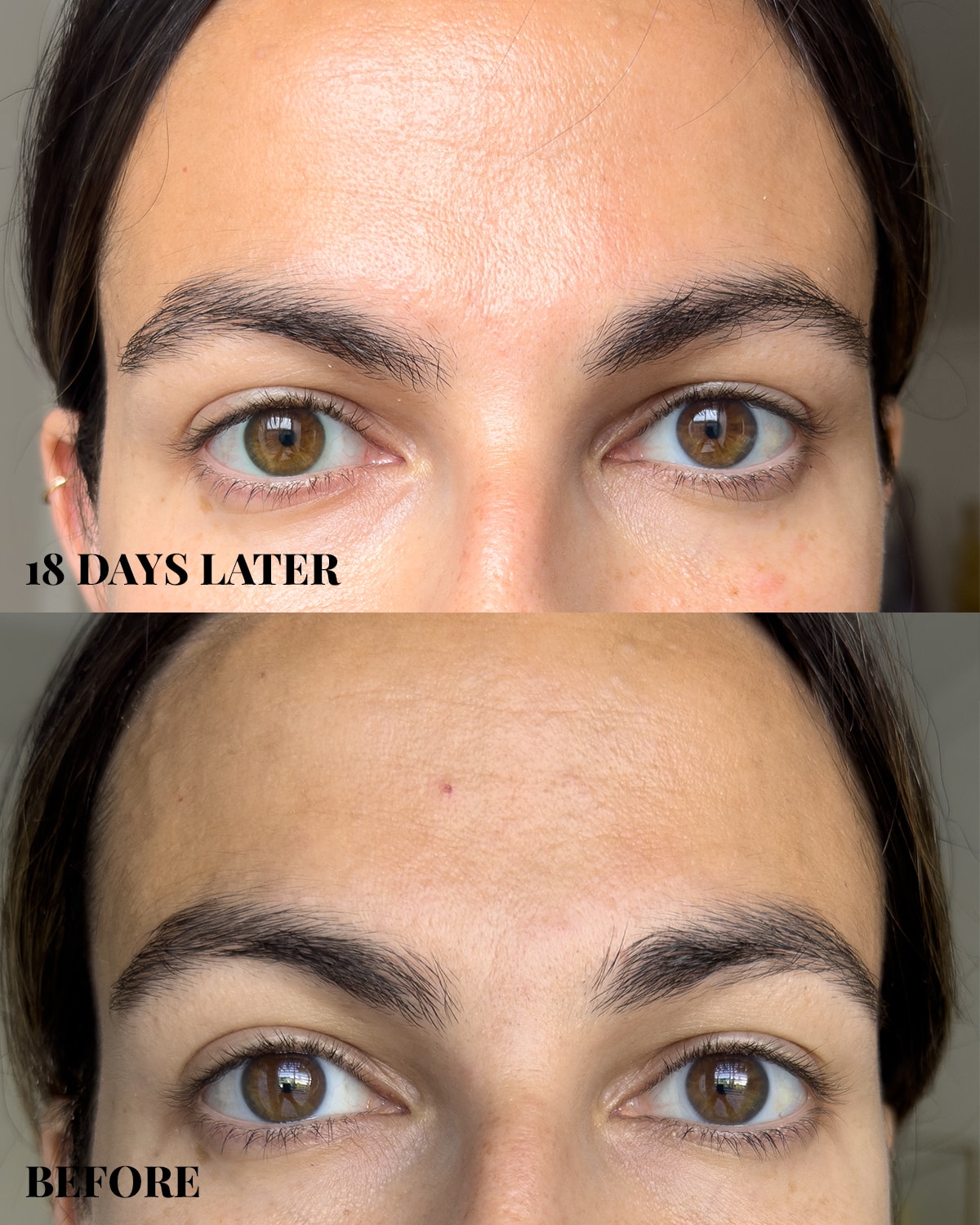 ZIIP Halo before and after ZIIP Halo before and after